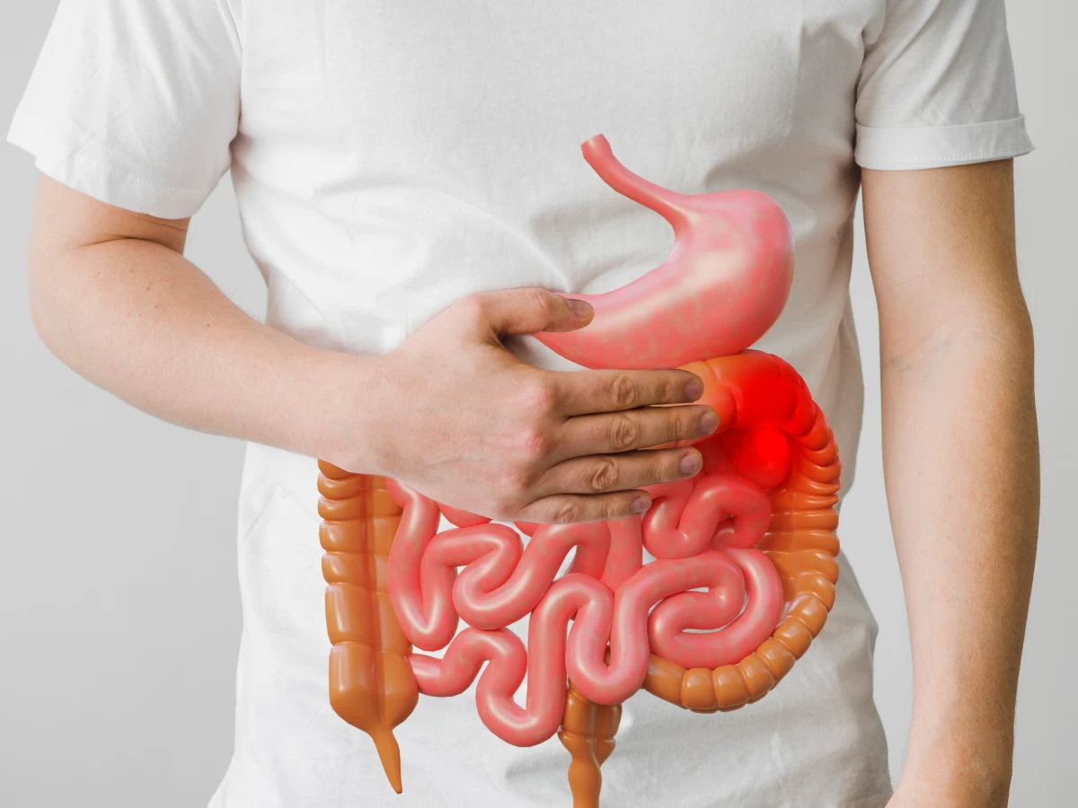 crohns disease gastro health 1