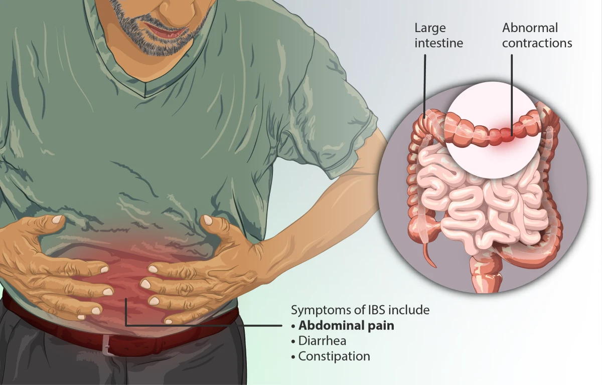 internal bowel syndrome gastro health 1